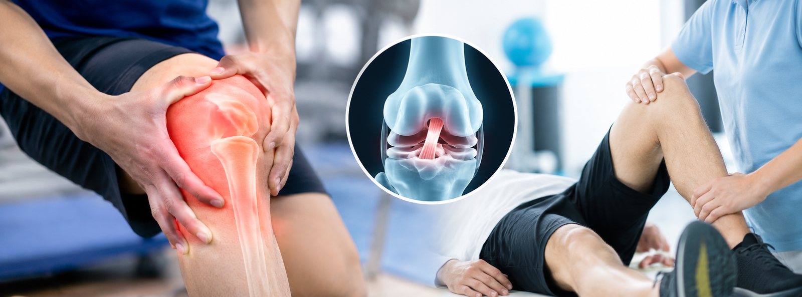 ACL Reconstruction Treatment in Patna: Symptoms, Procedure, Recovery & Expert Care